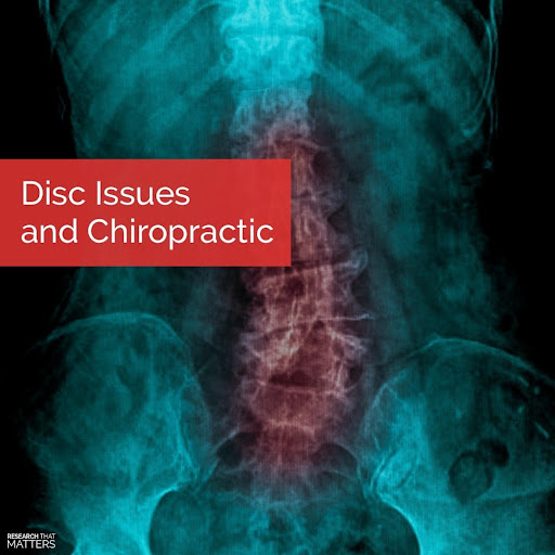 disc-issues-chiropractic